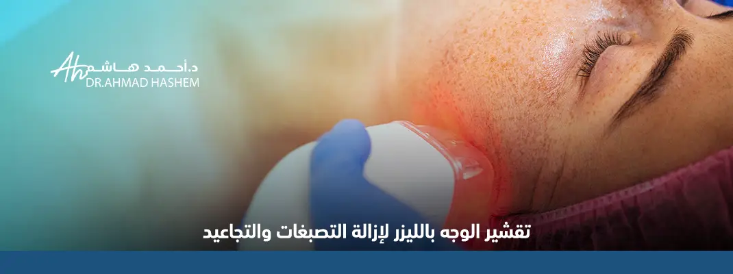 تقشير الوجه بالليزر​