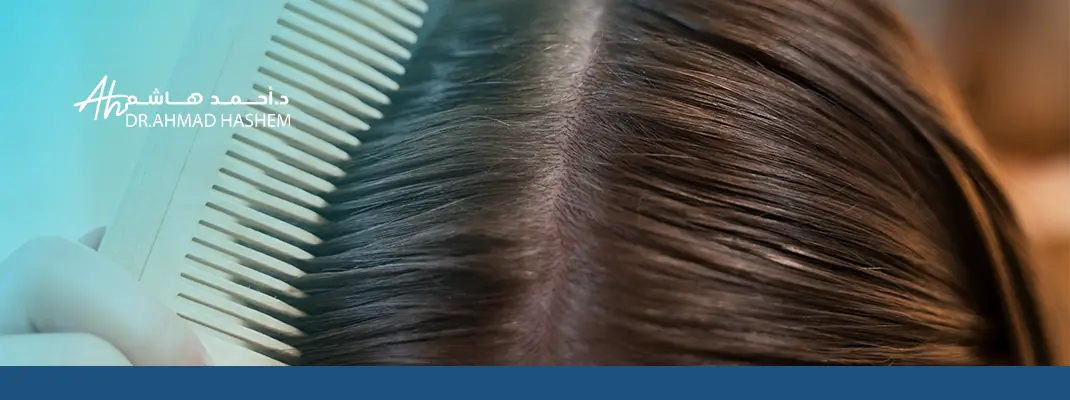 حلول فعالة لتكثيف الشعر وتوقف التساقط بسرعة 03