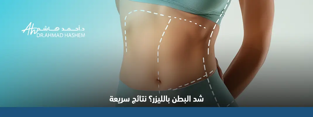 شد-البطن-بالليزر.webp