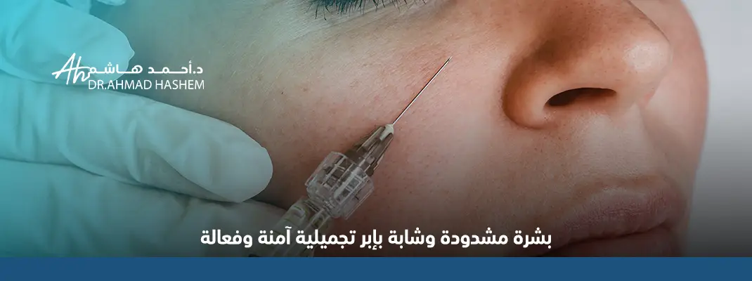 فيلر لشد الوجه