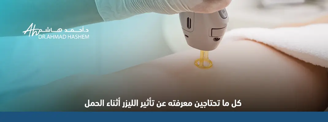 كل ما تحتاجين معرفته عن تأثير الليزر أثناء الحمل 01