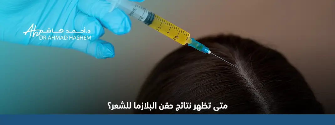 متى تظهر نتائج حقن البلازما للشعر؟