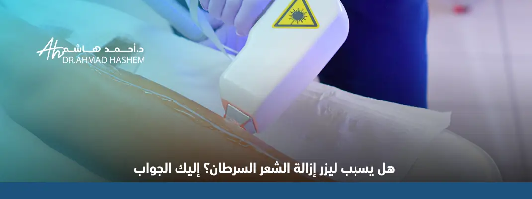 هل-يسبب-ليزر-إزالة-الشعر-السرطان.webp