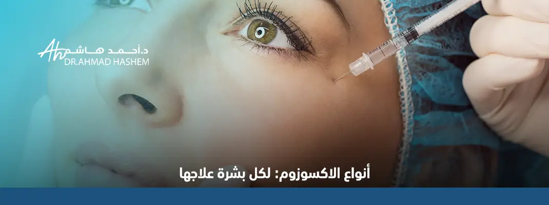 أنواع الاكسوزوم