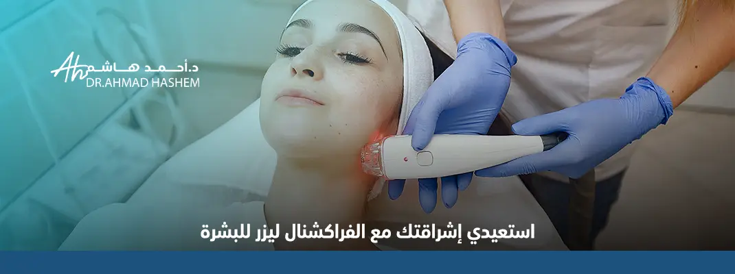 تجربتي مع ليزر الفراكشنال