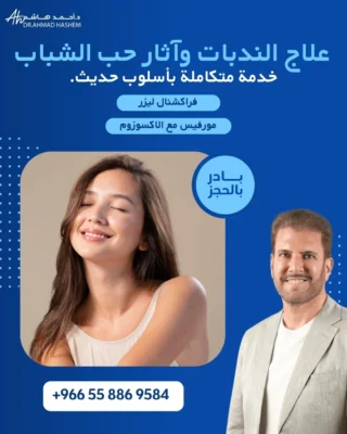 علاج الندبات وحب الشباب