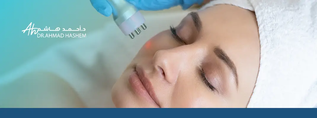 فوائد الفراكشنال ليزر لحب الشباب