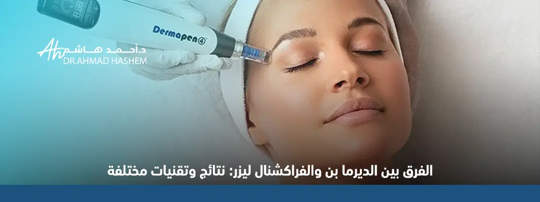 ما الفرق بين الديرما بن والفراكشنال ليزر
