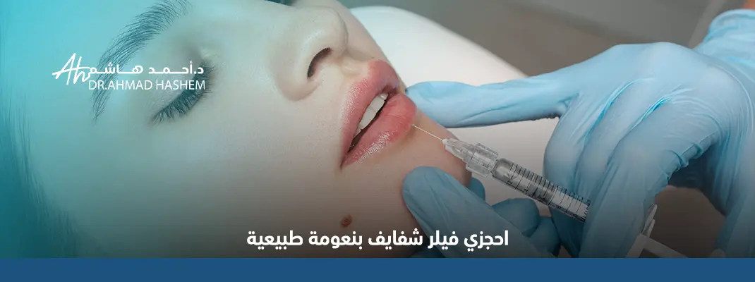 أنواع فيلر الشفايف