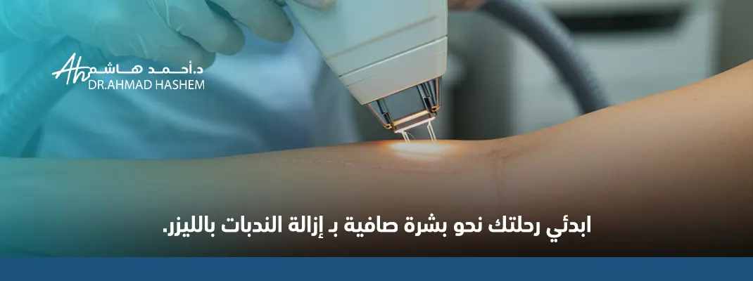 إزالة الندبات بالليزر قبل وبعد