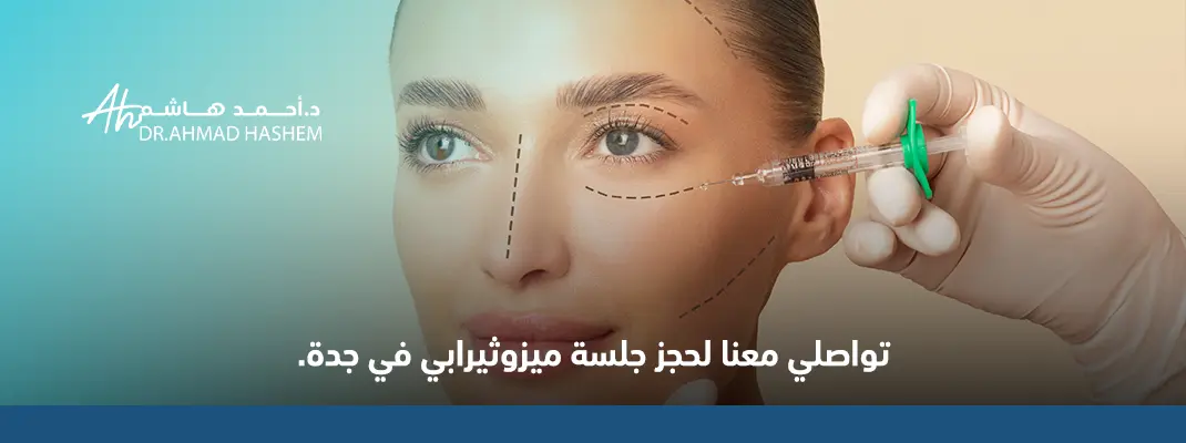 الميزوثيرابي للوجة