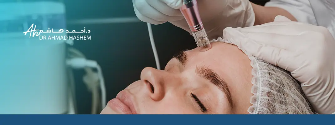 امبولات ميزوثيرابي للوجه