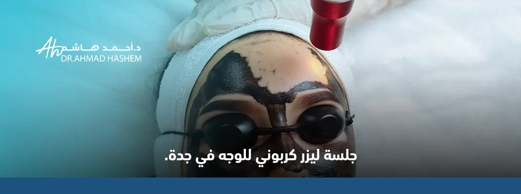 تجربتي مع الليزر الكربوني في جدة