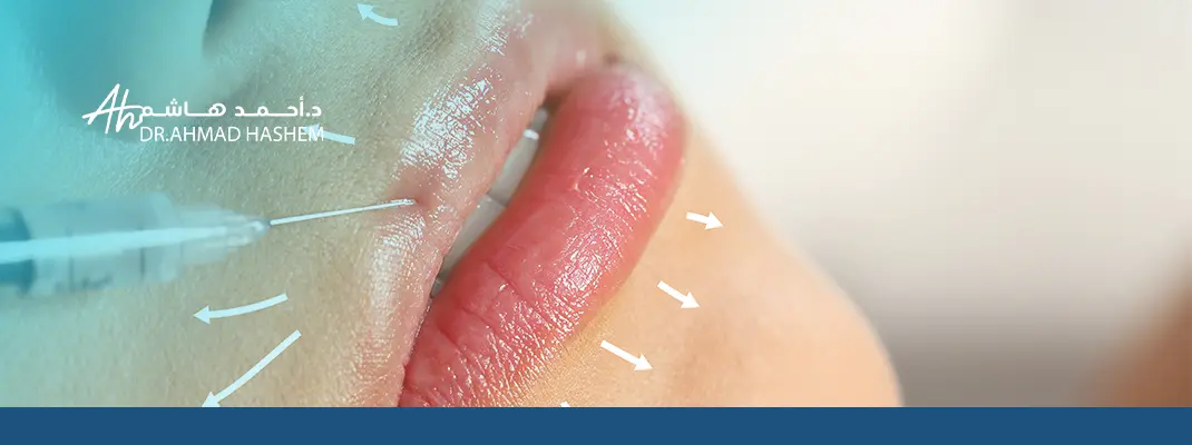 تجربتي مع فيلر الشفايف