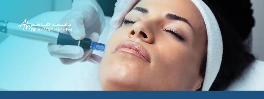جلسة ديرما بن للوجه قبل وبعد