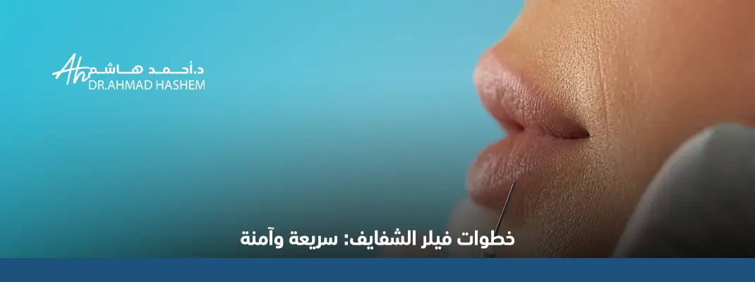 خطوات فيلر الشفايف