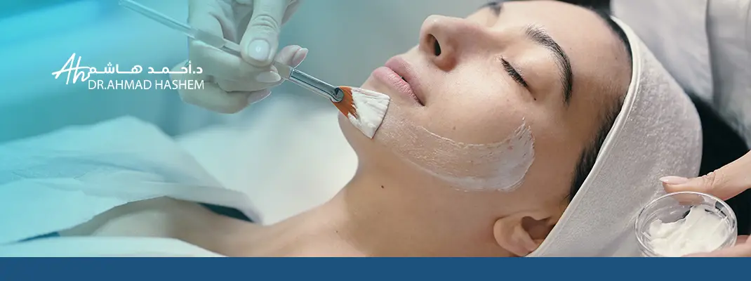 فوائد التقشير الكيميائي للبشرة الدهنية