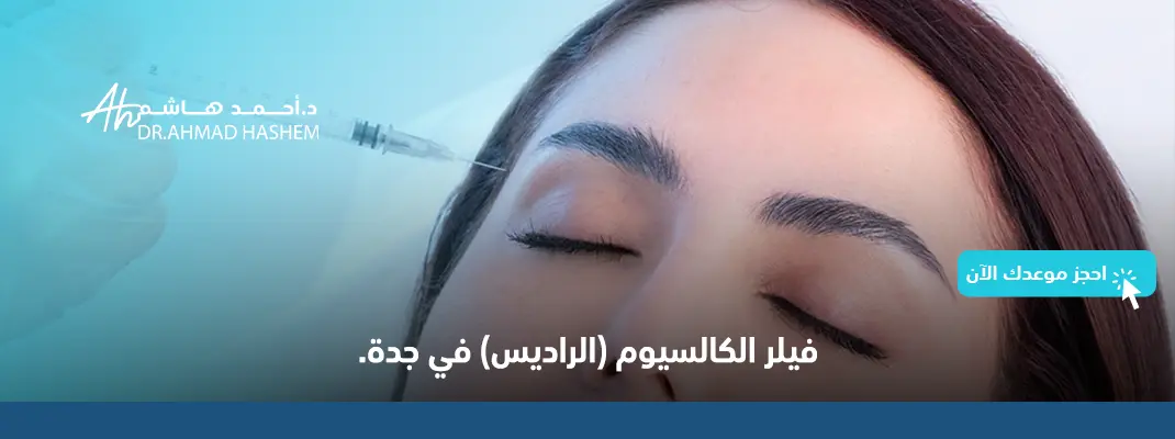 فيلر الراديس في جدة