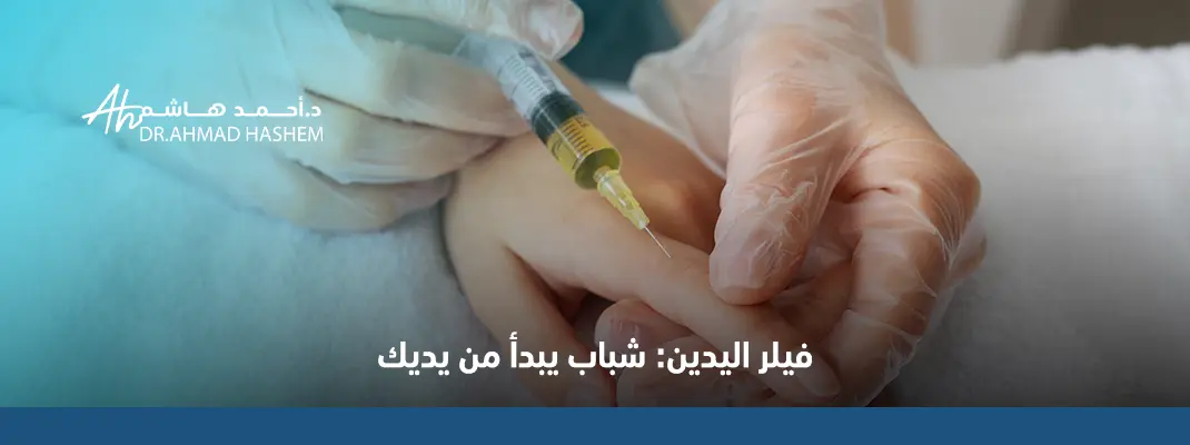 فيلر اليدين​