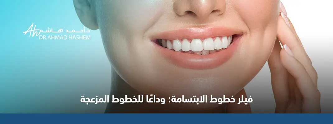 فيلر خطوط الابتسامه​