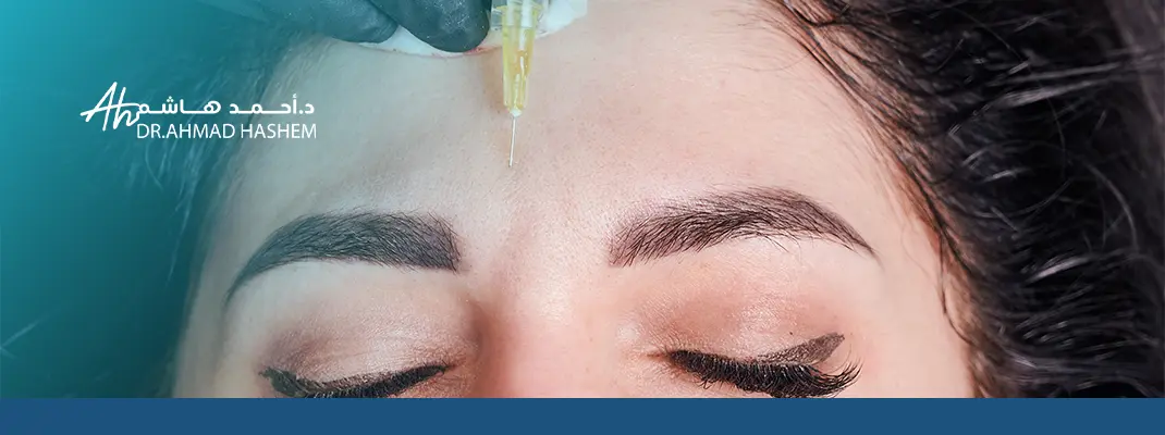 فيلر ستايلج لتحت العين