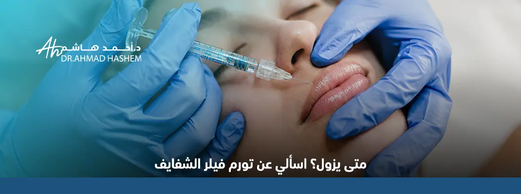 قساوة الشفايف بعد الفيلر