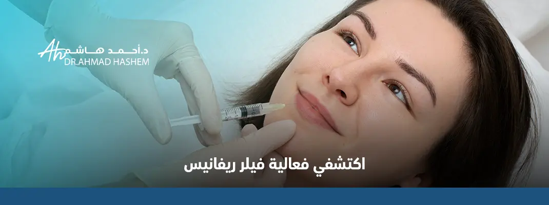 ما هو فيلر ريفاينس