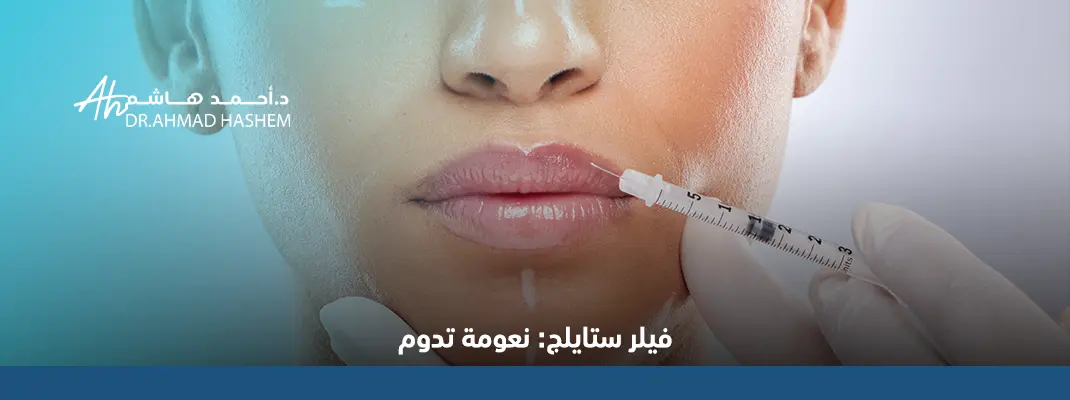 ما هو فيلر ستايلج