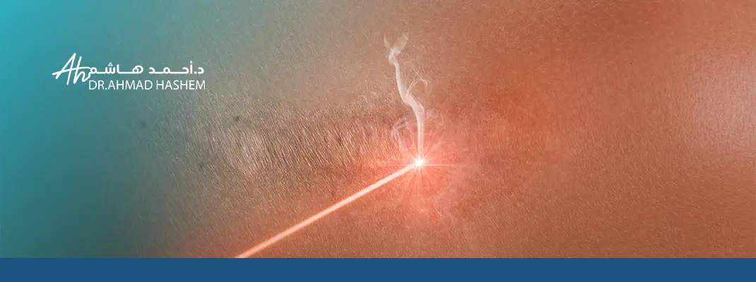 مدة علاج الندبات بالليزر