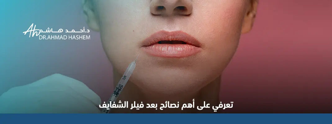 نصائح بعد فيلر الشفايف