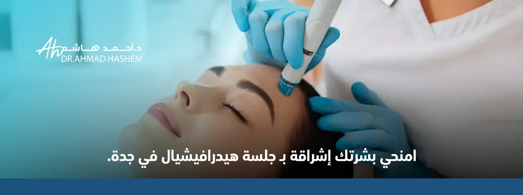 هيدرافيشل قبل المناسبة