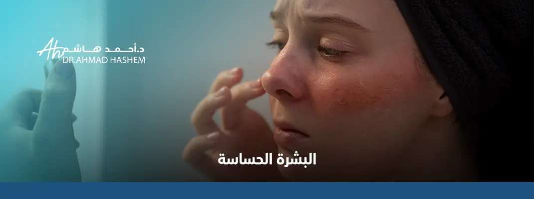 أعراض البشرة الحساسة