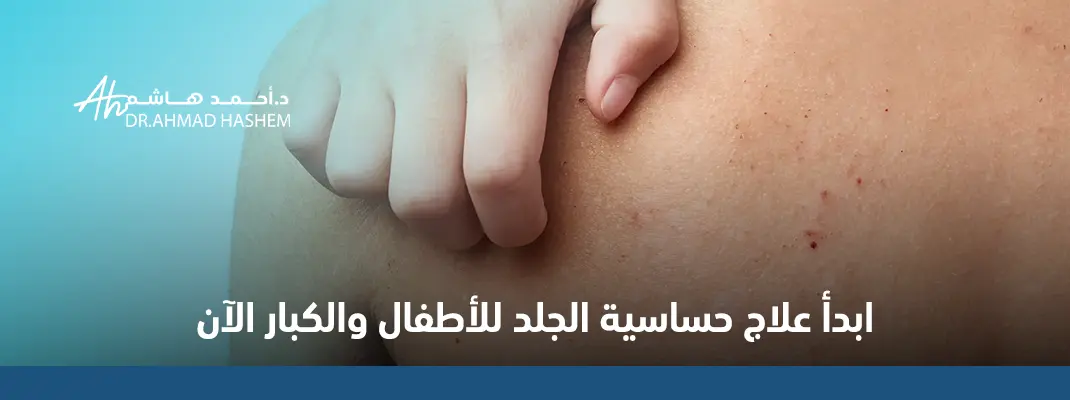 أنواع حساسية الجلد بالصور