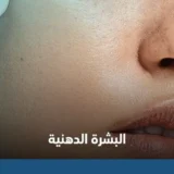 البشرة الدهنية