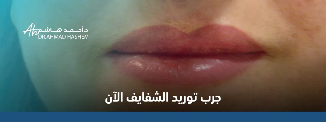 تجربتي مع تاتو الشفايف