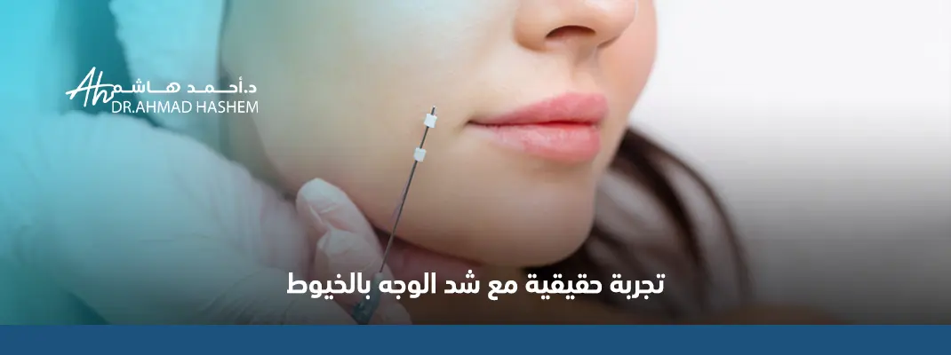 تجربتي مع شد الوجه بالخيوط