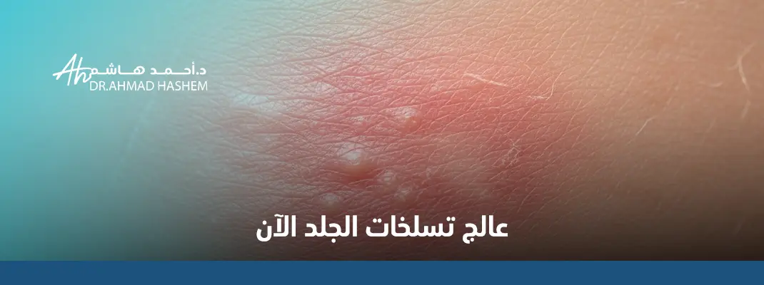 تسلخ الجلد في المناطق الحساسة للنساء