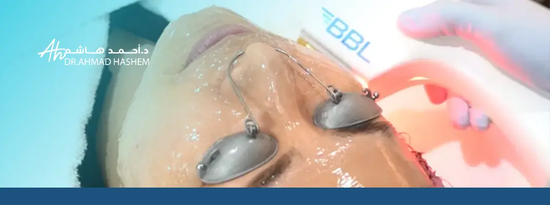 تقنية BBL للوجه