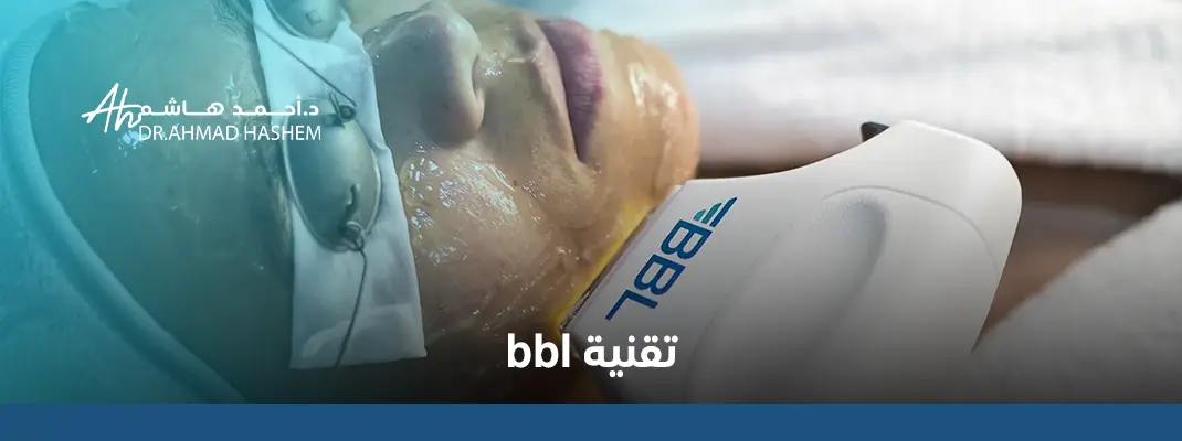 تقنية bbl