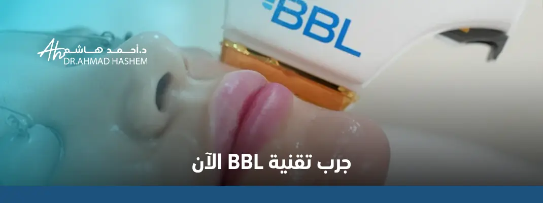 جهاز BBL