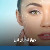 جهاز اندياج ليزر