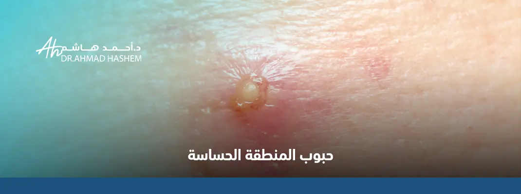 حبوب-المنطقة-الحساسة.webp