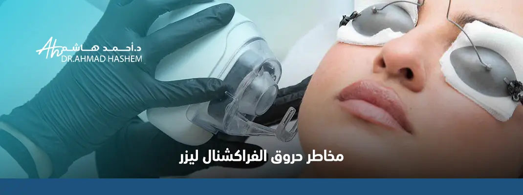حروق الفراكشنال ليزر