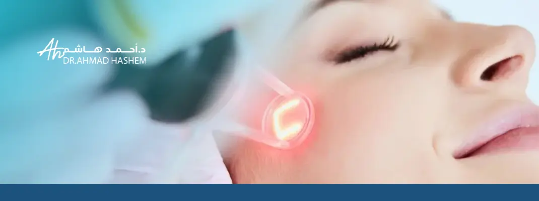 حروق الفراكشنال