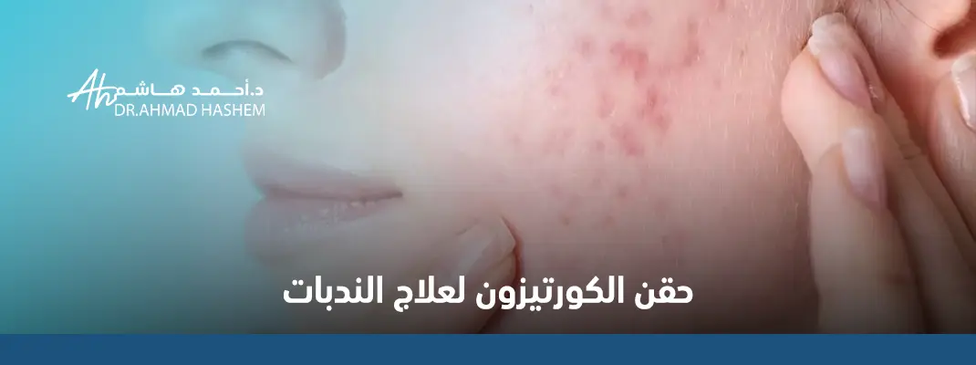 حقن-الكورتيزون-لعلاج-الندبات.webp