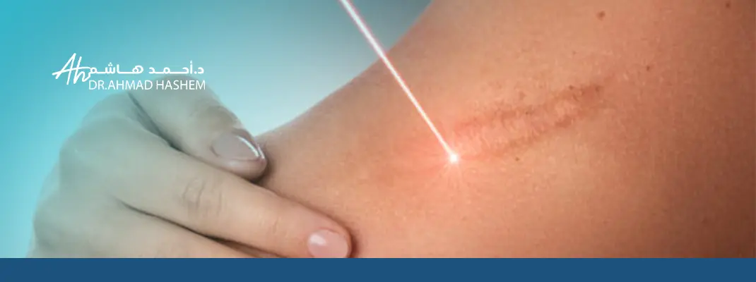 علاج الندبات القديمة بالكورتيزون