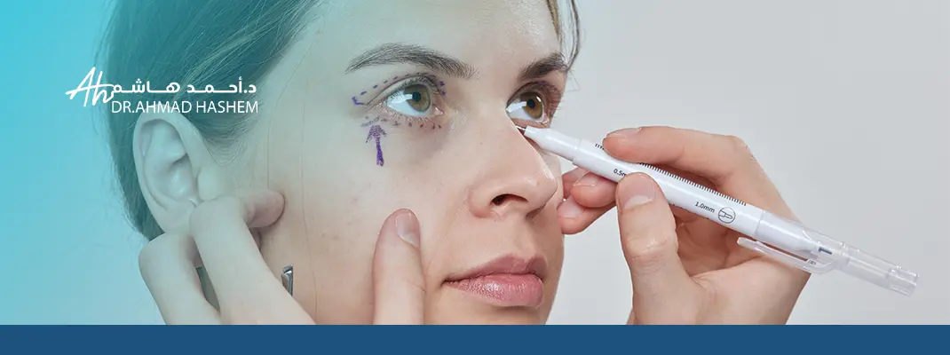 افضل نوع فيلر تحت العين