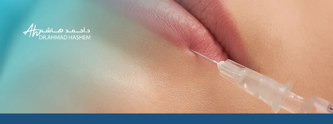 تحديد الشفاه بالفيلر