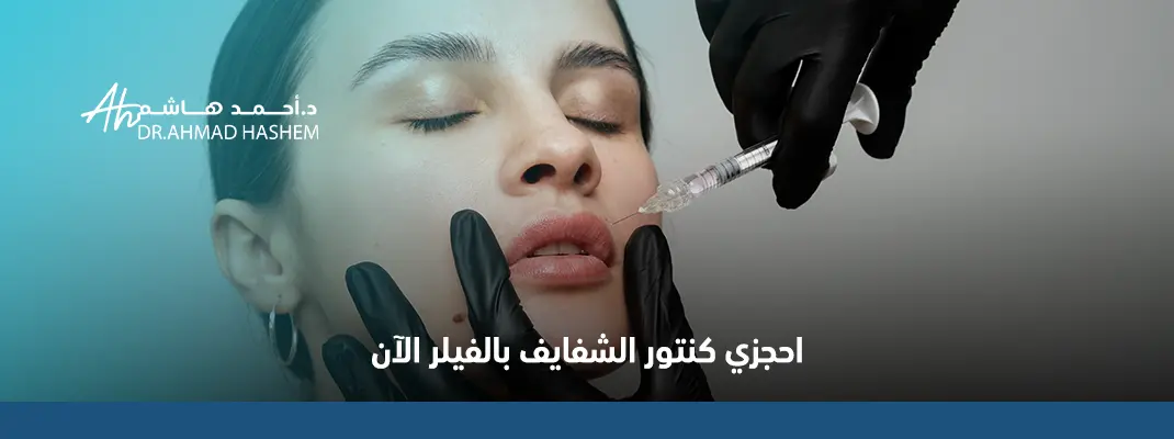 فيلر تحديد الشفايف