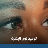 توحيد لون البشرة